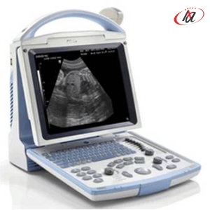 Máy Siêu Âm Mindray DP - 10
