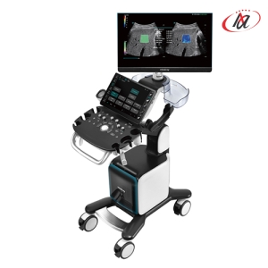 Máy siêu âm Consona N9